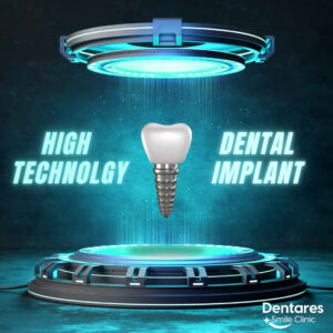 dental implants turkey cost